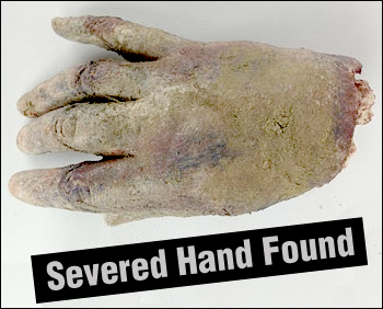 Drunken farmer arrested after brandishing severed hand Drunken farmer arrested after brandishing severed hand